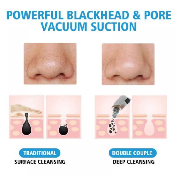 Electric Suction Blackhead Remover